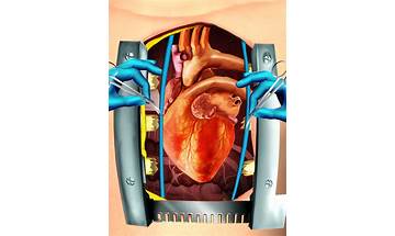 Heart Surgery Simulator Game for Android - Download the APK from Habererciyes